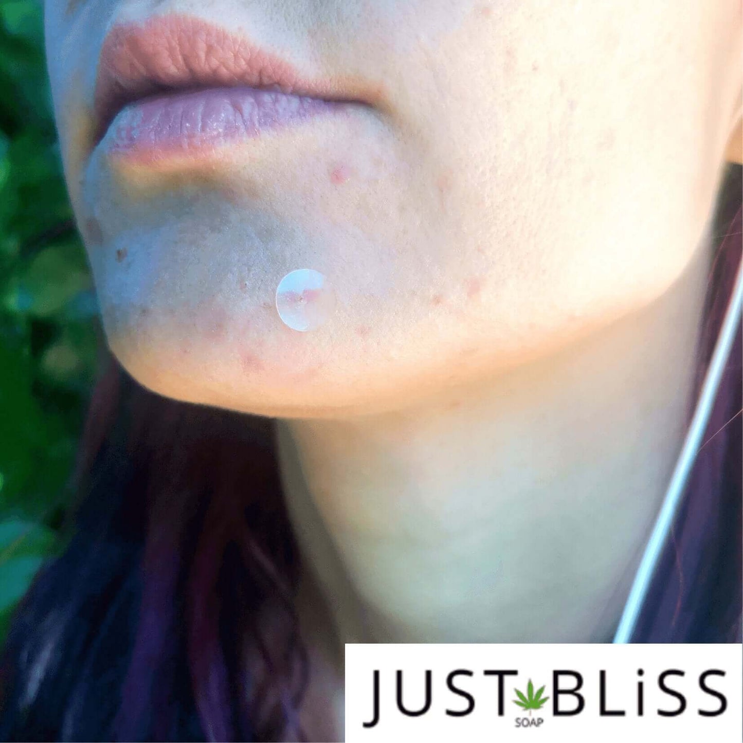 JUSTBLISS: Skin Care: Pimple Patches