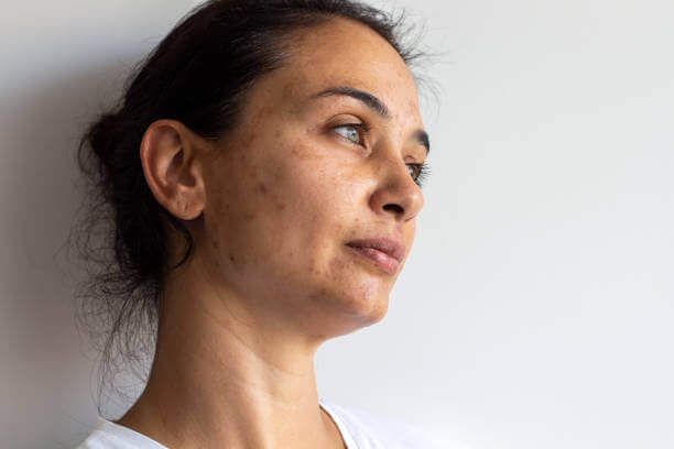 7 SIGNS OF UNHEALTHY SKIN - JUSTBLiSS Naturals