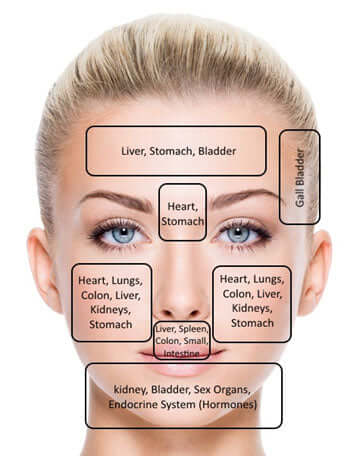 FACE MAPPING: WHAT YOUR PIMPLES ARE TRYING TO TELL YOU - JUSTBLiSS Naturals