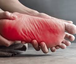 UNDERSTANDING NEUROPATHY IN THE FEET - JUSTBLiSS Naturals