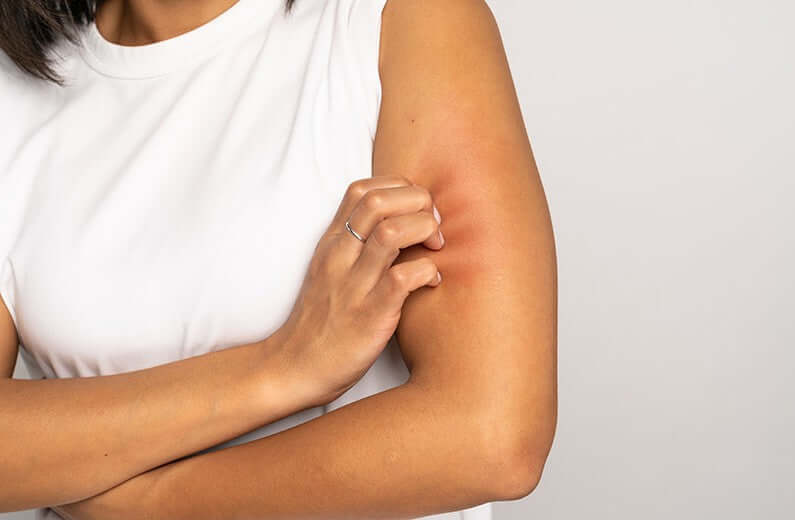 WHAT IS DRY SKIN? - JUSTBLiSS Naturals