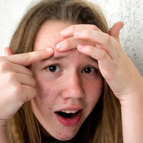TEENS - JUSTBLiSS Naturals