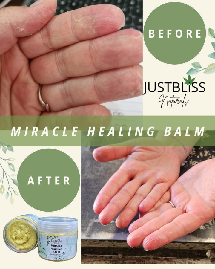 Healing Miracle Balm – Plant-Based Relief for Burns, Cuts &amp; Irritated Skin - JUSTBLiSS Naturals