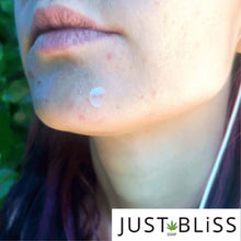 Load image into Gallery viewer, JUSTBLISS: Skin Care: Pimple Patches
